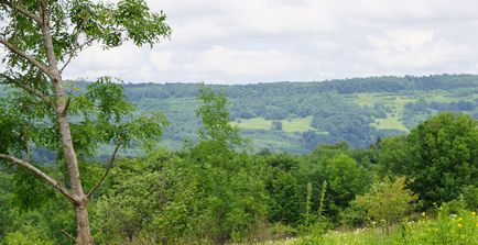 Гіпертиреоз (тиреотоксикоз)