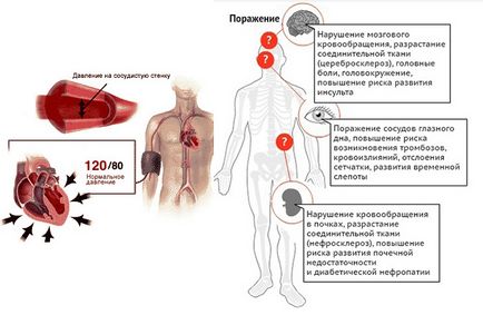 Йога при гіпертонії, йога, slavyoga