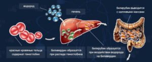 Як знизити білірубін в крові швидко в домашніх умовах ліками і народними засобами