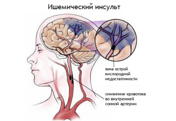 Diagnosticarea CT a creierului - descrierea și adresele centrelor medicale