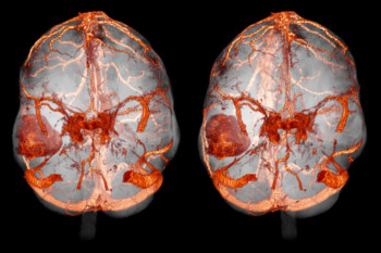 Кт діагностика головного мозку - опис і адреси медичних центрів