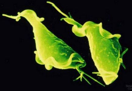 Krónikus kezelés A trichomoniasis nőknél (krónikus trichomoniasis) Krónikus trichomoniasis nőknél