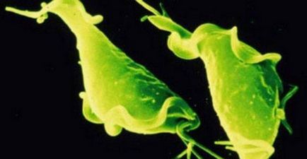Krónikus trichomoniasis nők (nők) Krónikus trichomoniasis nőknél