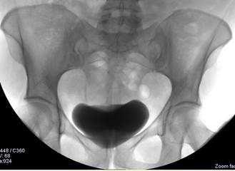 Radiodiagnostic în urologie