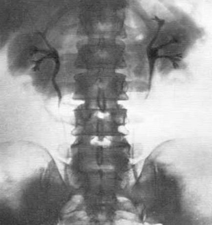 Sugárzás diagnosztikai módszerek Urológia