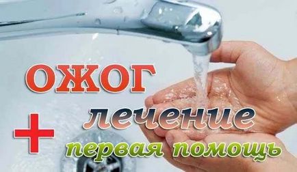 Кращі народні засоби від опіків - як лікувати опіки від сонця і окропу