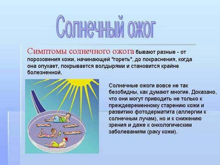 Кращі народні засоби від опіків - як лікувати опіки від сонця і окропу