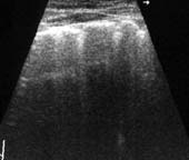 Nold - numărul 1-2, 2002 - tehnica de screening a diagnosticului cu ultrasunete a cancerului de colon