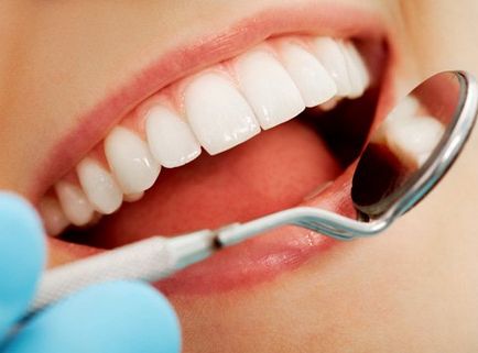 Відбілювання зубів air flow - протипоказання, переваги та ціна