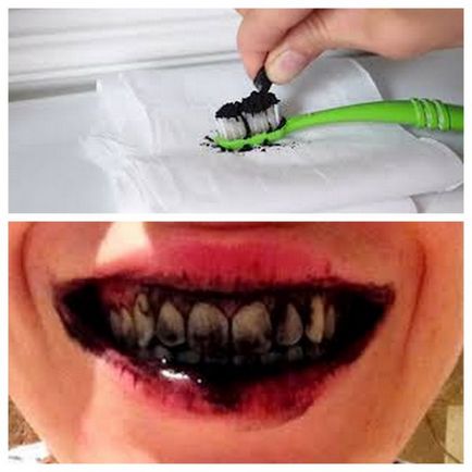 Відбілювання зубів содою, золою в домашніх умовах