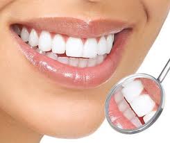 Відгуки про відбілюванні зубів