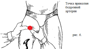 Compresia degetelor arterelor în timpul mesei de sângerare, algoritm, schemă, repere, puncte