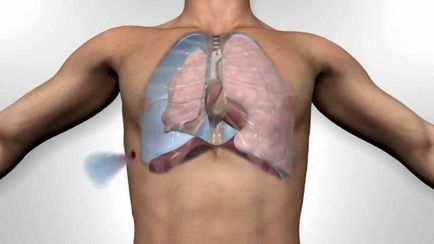 Pneumothorax a röntgen veszélyre utaló jelek szempontjából, az alternatív