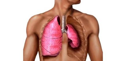 Pneumothorax a röntgen veszélyre utaló jelek szempontjából, az alternatív