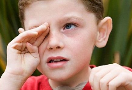 Чому дитина часто кліпає очима і мружиться, що робити причини і лікування