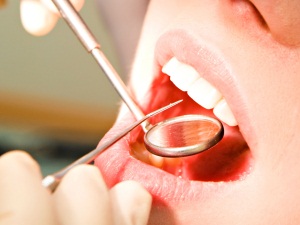 Профілактичний огляд у стоматолога допоможе зберегти вашу посмішку