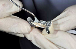 Самоадгезівние композитні цементи в практиці ортопедичної стоматології