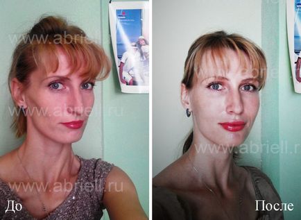 Pentru a face lipofilling, abrielle