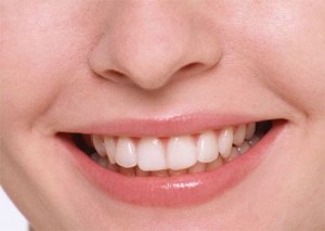 Tippek, hogyan kell összehangolni a fogak otthon, központosított fogtechnikai laboratórium