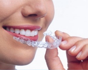 Поради як вирівняти зуби в домашніх умовах, централізована зуботехнічна лабораторія