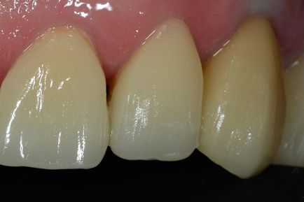 Стоматологічний журнал dental magazine - cerec