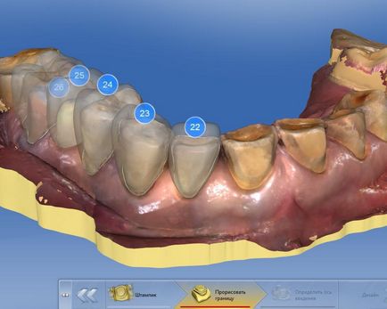 Стоматологічний журнал dental magazine - cerec