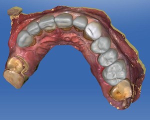 Dental Journal fogászati ​​magazin - CEREC