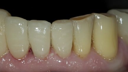 Dental Journal fogászati folyóirat - CEREC (két óra) Dental Journal fogászati magazin - CEREC