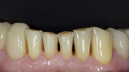 Dental Journal fogászati folyóirat - CEREC (CEREC) Dental Journal fogászati magazin - CEREC