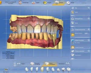 Dental Journal fogászati ​​magazin - CEREC