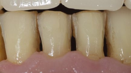 Dental Journal fogászati folyóirat - CEREC (CEREC) Dental Journal fogászati magazin - CEREC