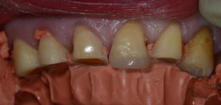 Dental Journal fogászati folyóirat - CEREC (CEREC) Dental Journal fogászati magazin - CEREC