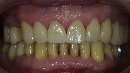 Стоматологічний журнал dental magazine - cerec