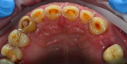 Стоматологічний журнал dental magazine - cerec