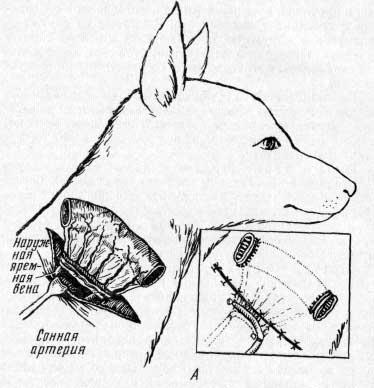 Transplantul intestinului subțire