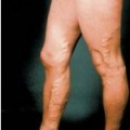 A sokoldalú m univerzális BIOMEDIS hatékony kezelésére arthritis és arthrosis, ízületek egészségét