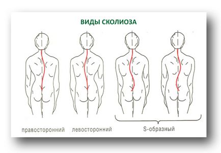 Exerciții pentru mușchii longitudinali ai spatelui - cum se pompează acasă și în hol