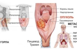 Узі горла і гортані