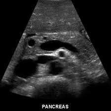 Uzi pancreas, norma de dimensiunea organului, cum să verificați ce arată fotografie, video