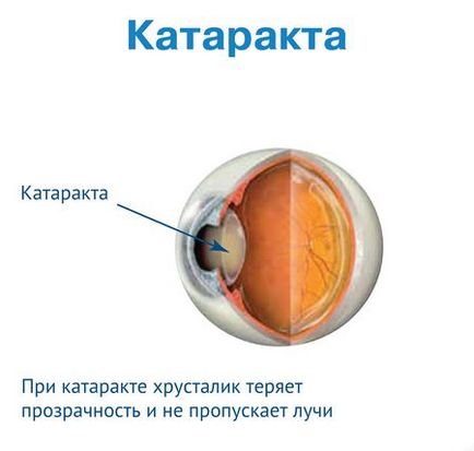 В оці наче то плаває, офтальмологія - лікування очей
