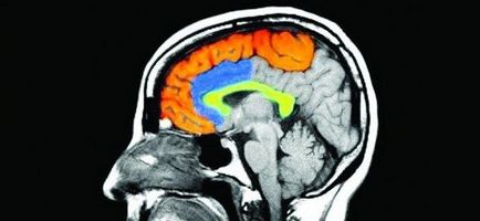 Tipuri de angiografie și tractografie arteriale cerebrale - portalul mrt