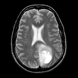 Medicament de Est pentru tratamentul hipertensiunii arteriale