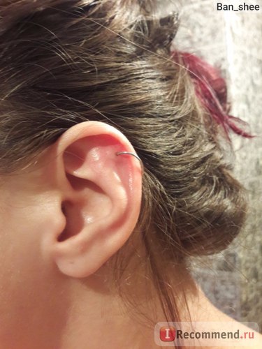 Helix (piercing al cartilajului urechii) - 