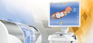 Художня реставрація зубів cerec 3d (Церек) технології та відгуки