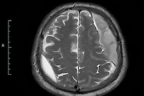 Boli ale nasului și sinusurilor paranazale - primirea medicului de la ORL la Moscova