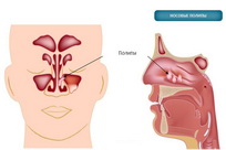 betegségek, az orr és az orrmelléküregek - vétel ENT orvos Moszkvában