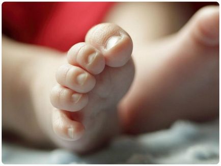 Білі плями на нігтях у дитини причини появи, діагноз, лікування