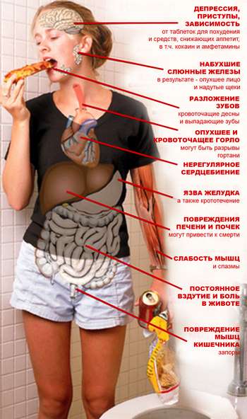 Ce este bulimia, care sunt simptomele ei?