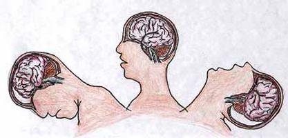 Difuze axonale simptome leziuni ale creierului, semne și diagnostic