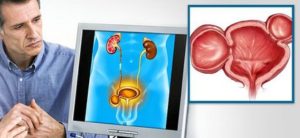 Distrucția vezicii urinare provoacă, simptome și tratament
